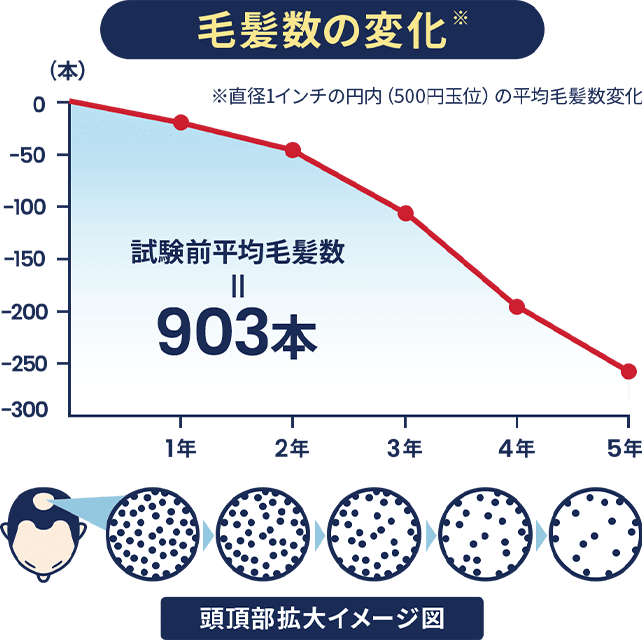 AGAの毛髪数の変化