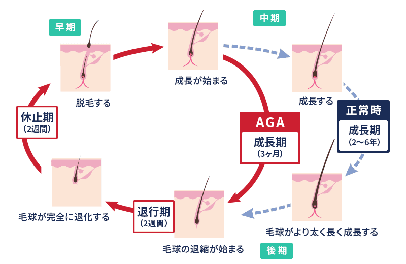 ヘアサイクル図