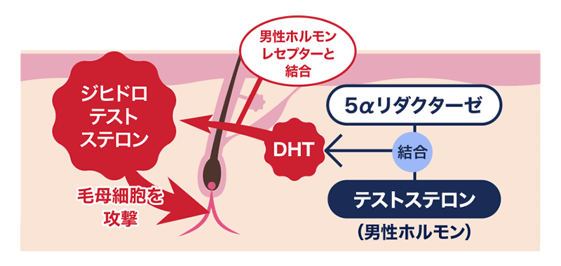 抜け毛の原因